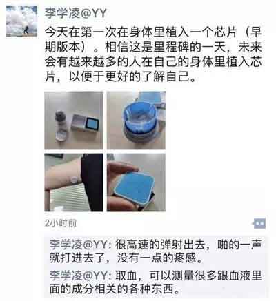 人体是科技的下一个前沿，芯片植入只是第一步